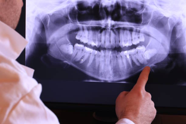 Best Emergency Dental Care for Broken or Chipped Teeth in Middletown, NY