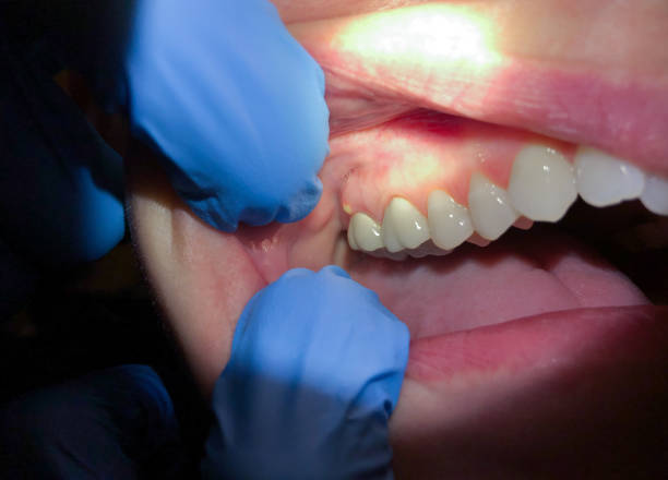 Best Cosmetic Emergency Dentistry in Middletown, NY